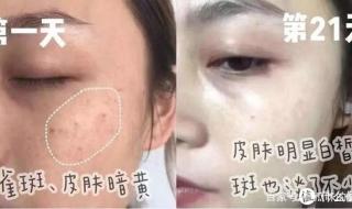 去黄美白产品排行榜 去黄美白产品排行榜